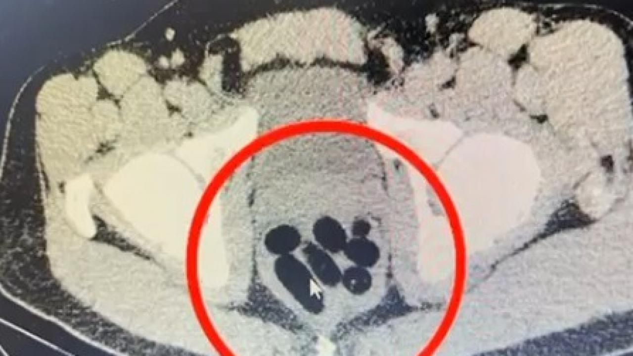 kayseride uyusturucu operasyonu midesinden cikan soke etti FUBT4jnT.jpg